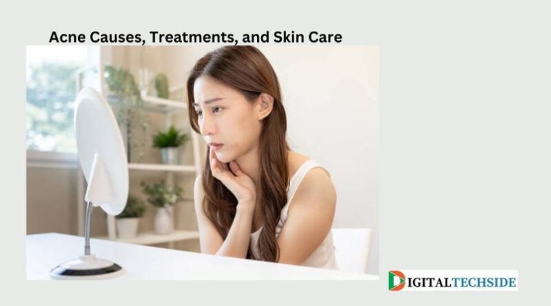 Acne Causes, Treatments, and Skin Care